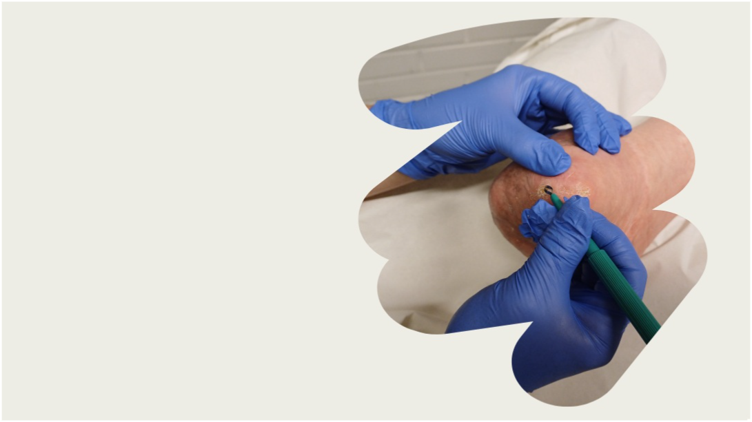 Jalkaterapia-Hyvinvointia jaloillesi