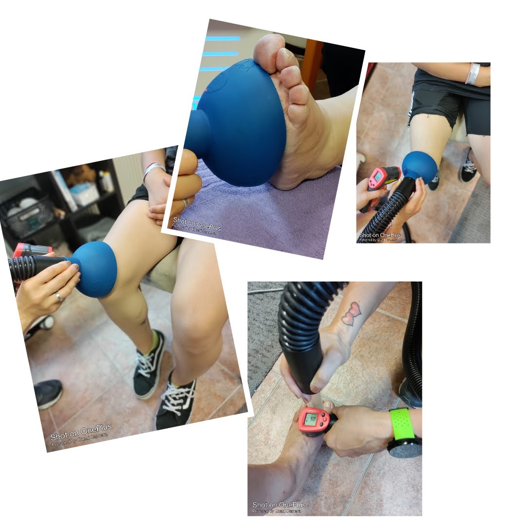 X Cryo huippukylmähoito