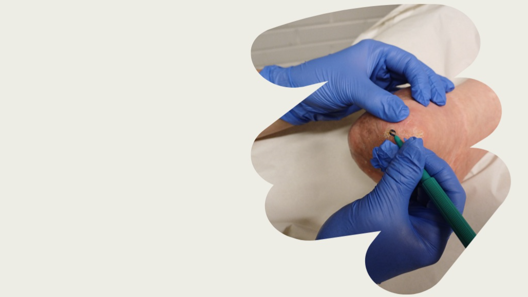 Jalkaterapia- Hyvinvointia jaloillesi