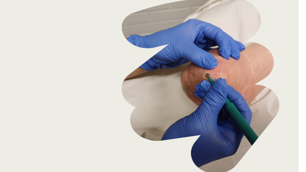 Jalkaterapia-Hyvinvointia jaloillesi