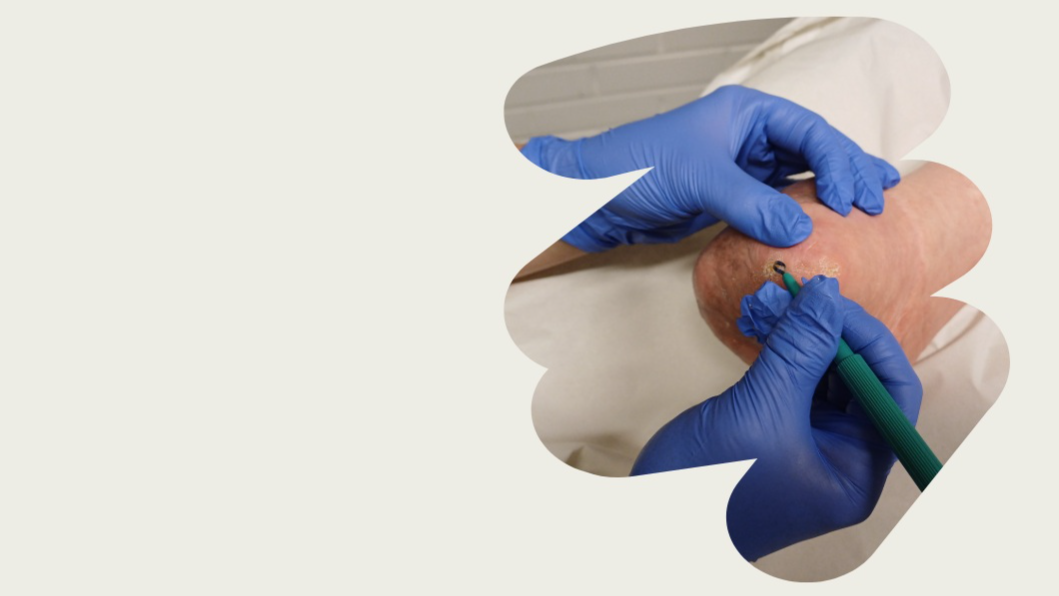 Jalkaterapia-Hyvinvointia jaloillesi